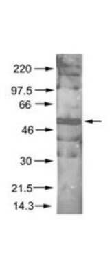 Western Blot: AKT1 [p Ser473] Antibody [NB600-590]